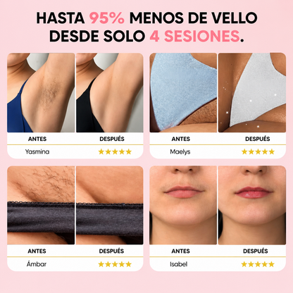 Depiladora de luz pulsada - Resultados visibles desde las primeras sesiones